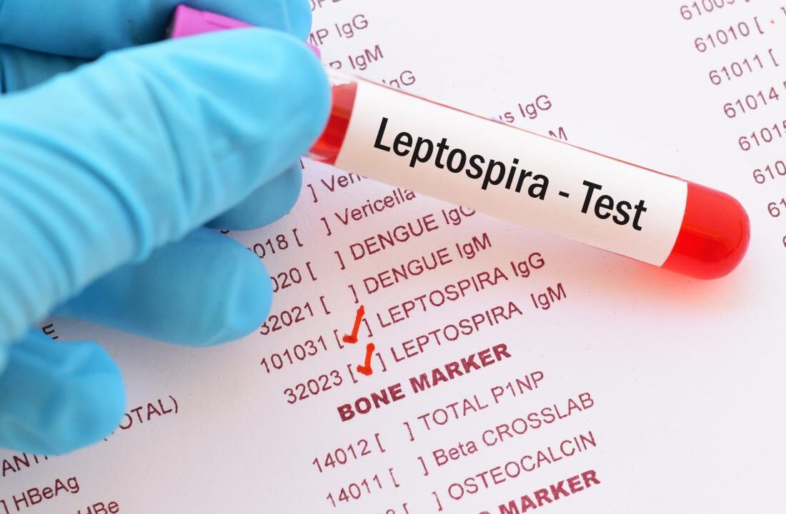 eptospirosis-is-a-bacterial-infection Mondocta - sante en Afrique docta