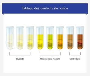 changement couleur d'urine