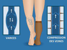 Jambes lourdes - Comment faire pour les soulager ?