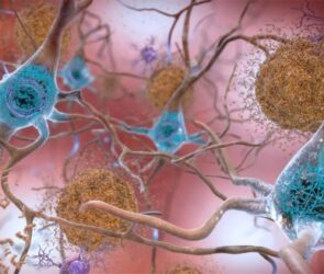 Traitements des symptômes comportementaux ou maladie d'Alzheimer