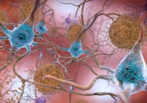 Traitements des symptômes comportementaux ou maladie d'Alzheimer