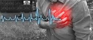 Palpitations : causes, prévention et traitements